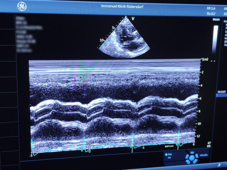 Ansicht von Herzultraschall