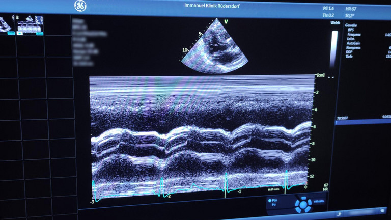 Ansicht von Herzultraschall
